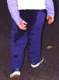 toes2a.jpg (8359 bytes)